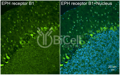 EPH receptor B1 (EPHB1) Antibody