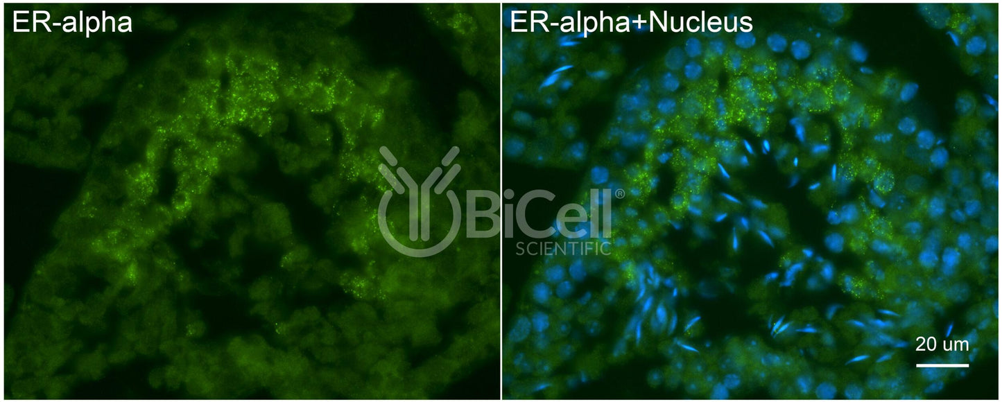 ER alpha (ESR1 or NR3A1) Antibody - FFPE Validated