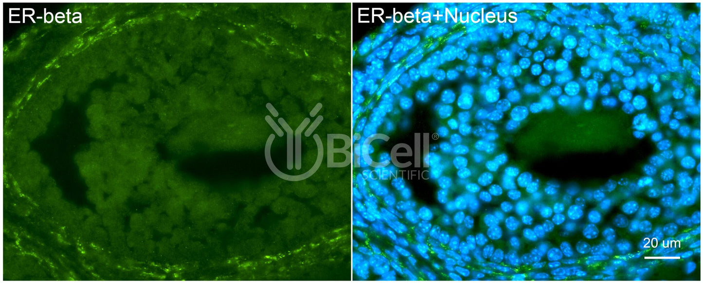 ER beta (ESR2 or NR3A2) Antibody - FFPE Validated