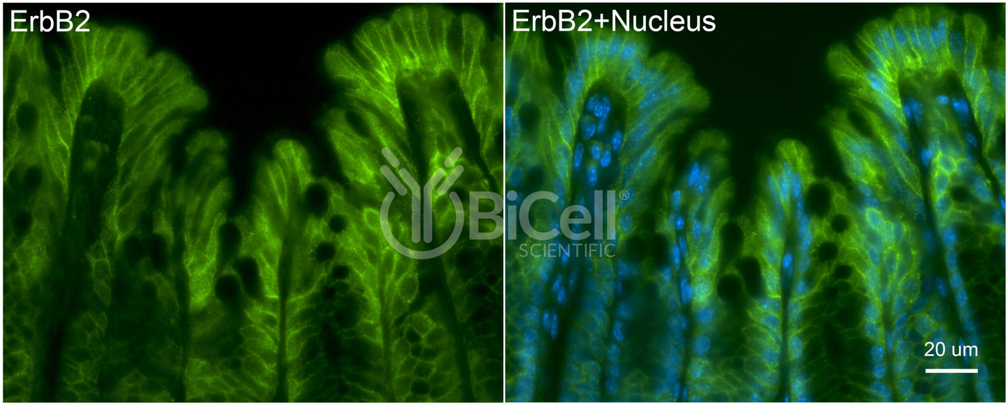 ErbB2 (HER2 or Neu or CD340) Antibody
