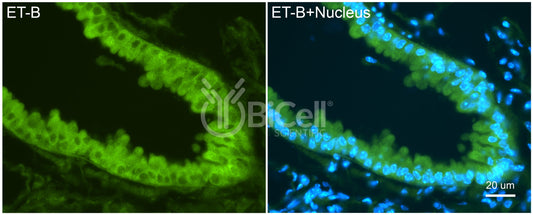 Ednrb (ET-B) Antibody - Western Blot Validated