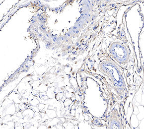 UCP1 Antibody