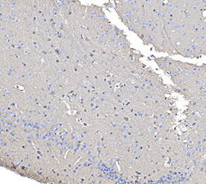 Phospho-Tau (Ser404) Antibody