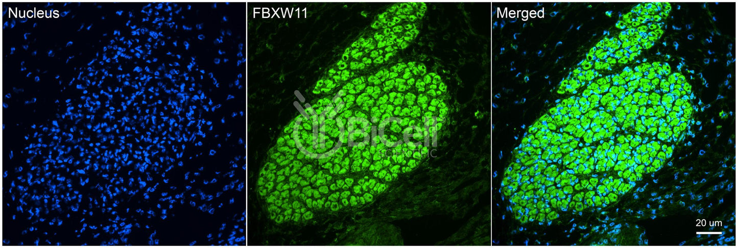 FBXW11 (BTRCP2 or NEDJED) (C-Terminus) Antibody - Western Blot Validated
