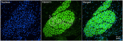 FBXW11 (BTRCP2 or NEDJED) (C-Terminus) Antibody - Western Blot Validated