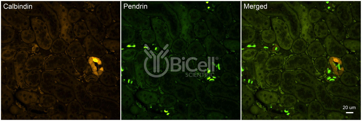 Calbindin-1 (CALB1 or Calbindin D-28K) Antibody