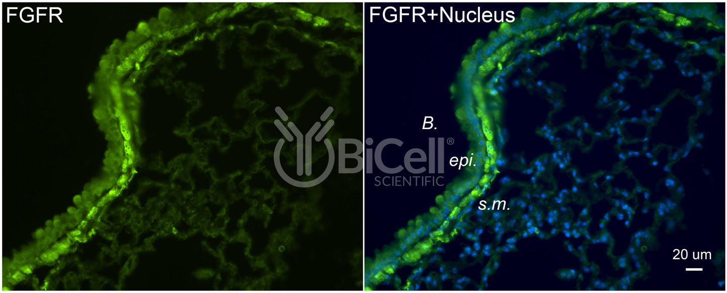 FGFR1 (FLT2 or CD331) Antibody