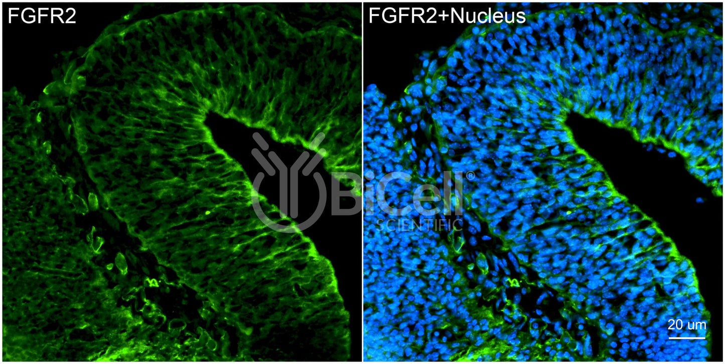 FGFR2 (CD332) Antibody