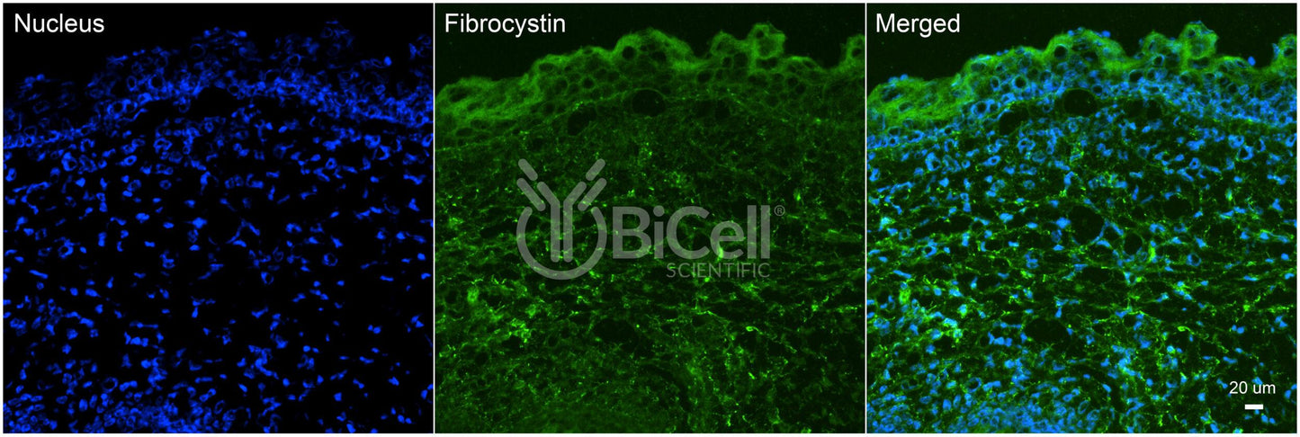 Fibrocystin (PKHD1 or ARPKD or PKD4) Antibody - Western Blot Validated