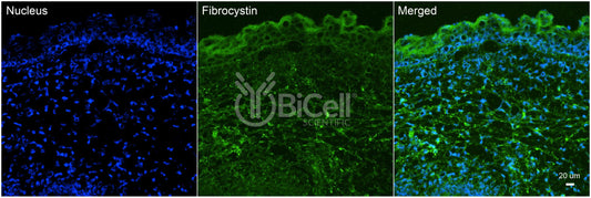 Fibrocystin (PKHD1 or ARPKD or PKD4) Antibody - Western Blot Validated