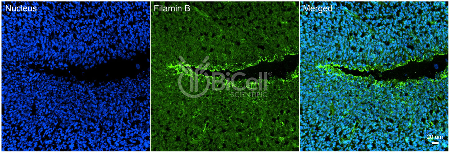 Filamin B (FLNB) Antibody - FFPE Validated