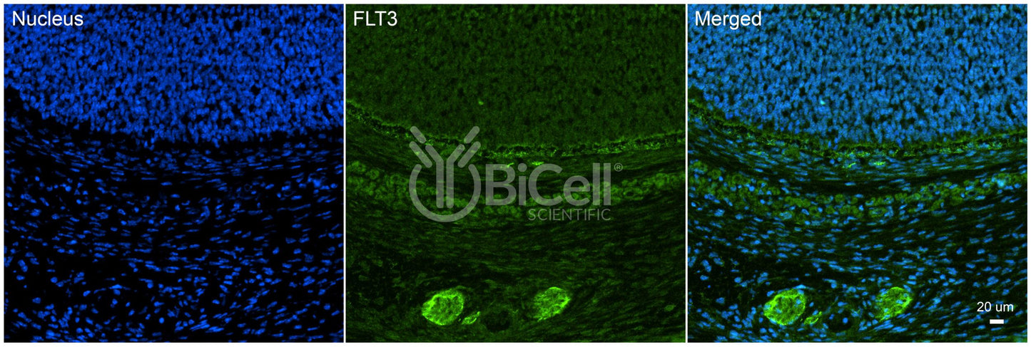 FLT3 (FLK2 or STK1 or CD135) Antibody - FFPE Validated