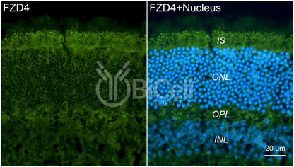 Frizzled-4 (FZD4) Antibody - FFPE Validated