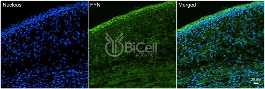 FYN (SLK) Antibody - Western Blot Validated