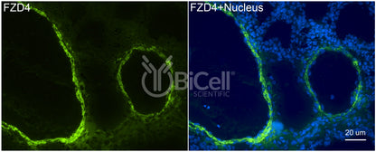 Frizzled-4 (FZD4) Antibody - Western Blot Validated