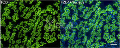 Frizzled-4 (FZD4) Antibody - Western Blot Validated