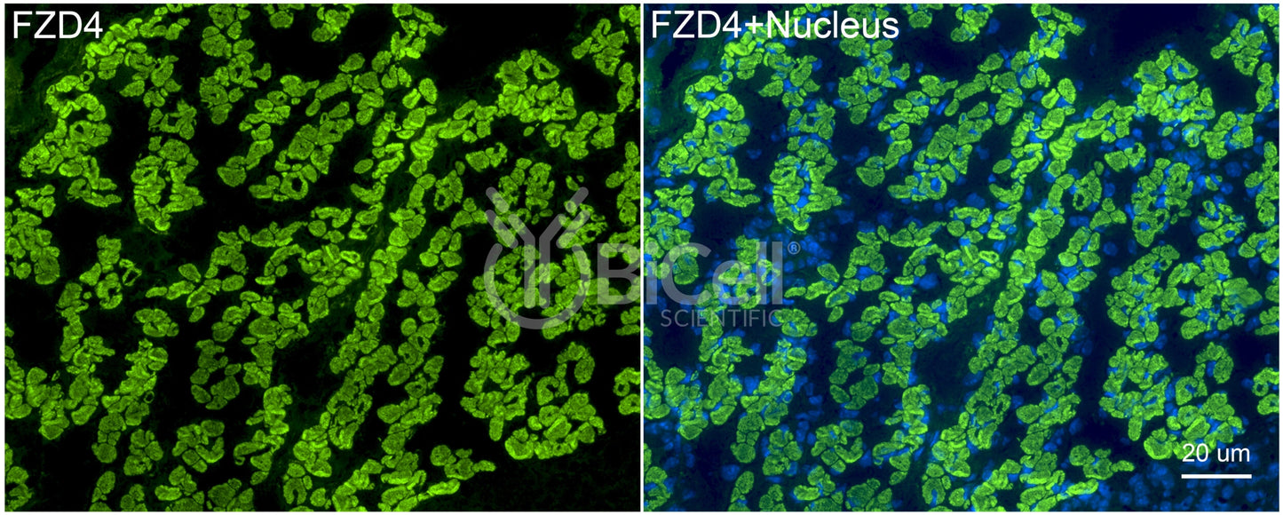 Frizzled-4 (FZD4) Antibody - FFPE Validated
