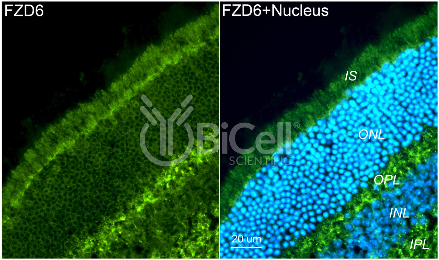 Frizzled-6 (FZD6) Antibody - Western Blot Validated