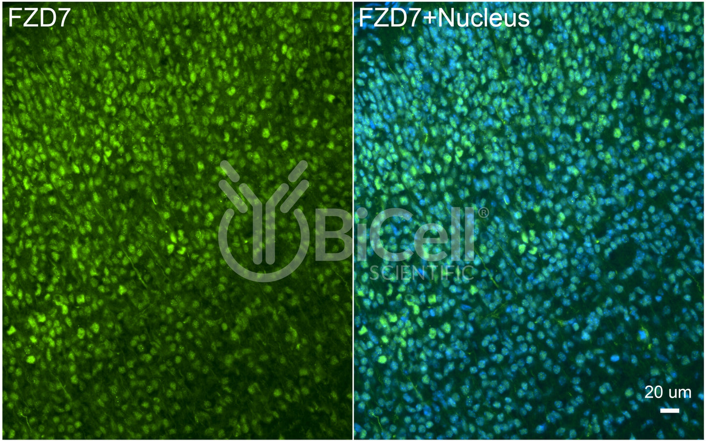 Frizzled-7 (FZD7) Antibody
