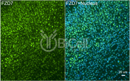 Frizzled-7 (FZD7) Antibody