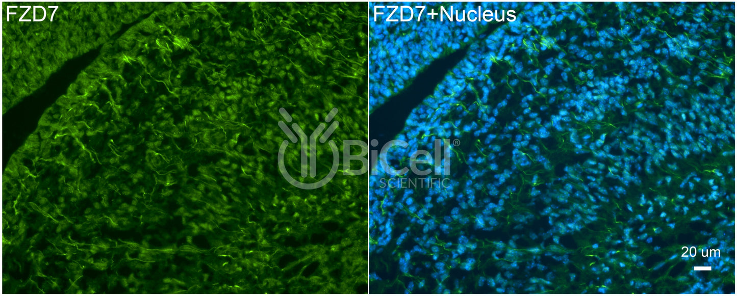 Frizzled-7 (FZD7) Antibody - FFPE Validated