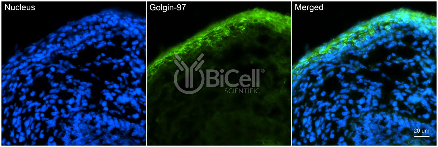 GOLGA1 (Golgin-97) Antibody - Western Blot Validated