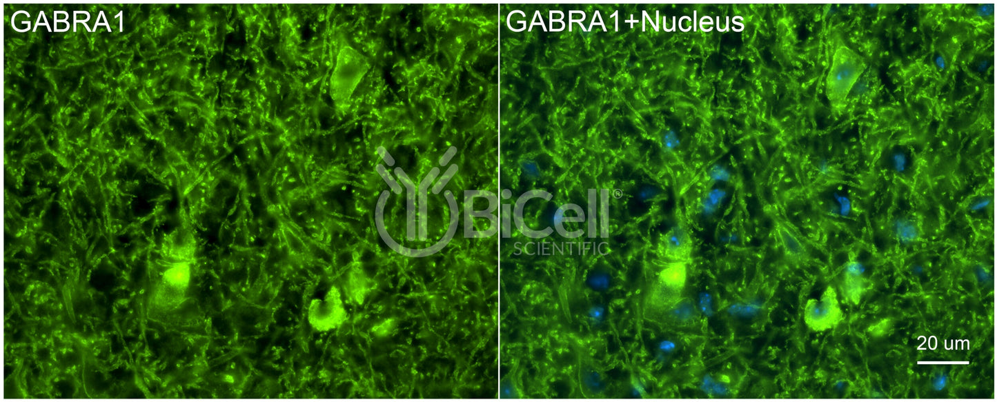 GABRA1 Antibody - Western Blot Validated