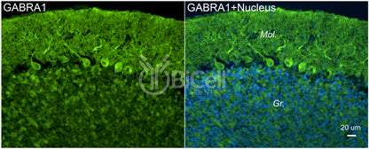GABRA1 Antibody - FFPE Validated