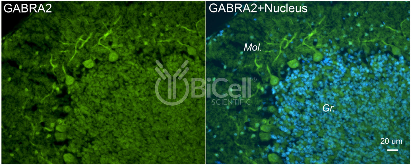 GABRA2 Antibody - FFPE Validated