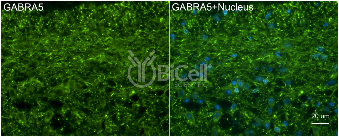 GABRA5 Antibody
