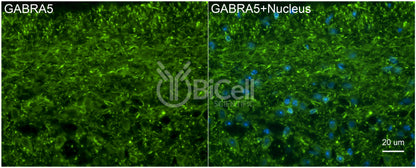 GABRA5 Antibody