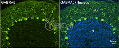 GABRA5 Antibody - FFPE Validated