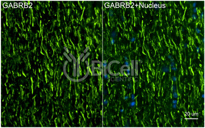 GABRB2 Antibody