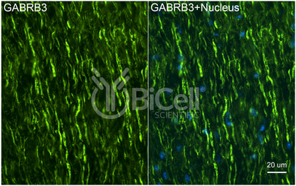 GABRB3 Antibody