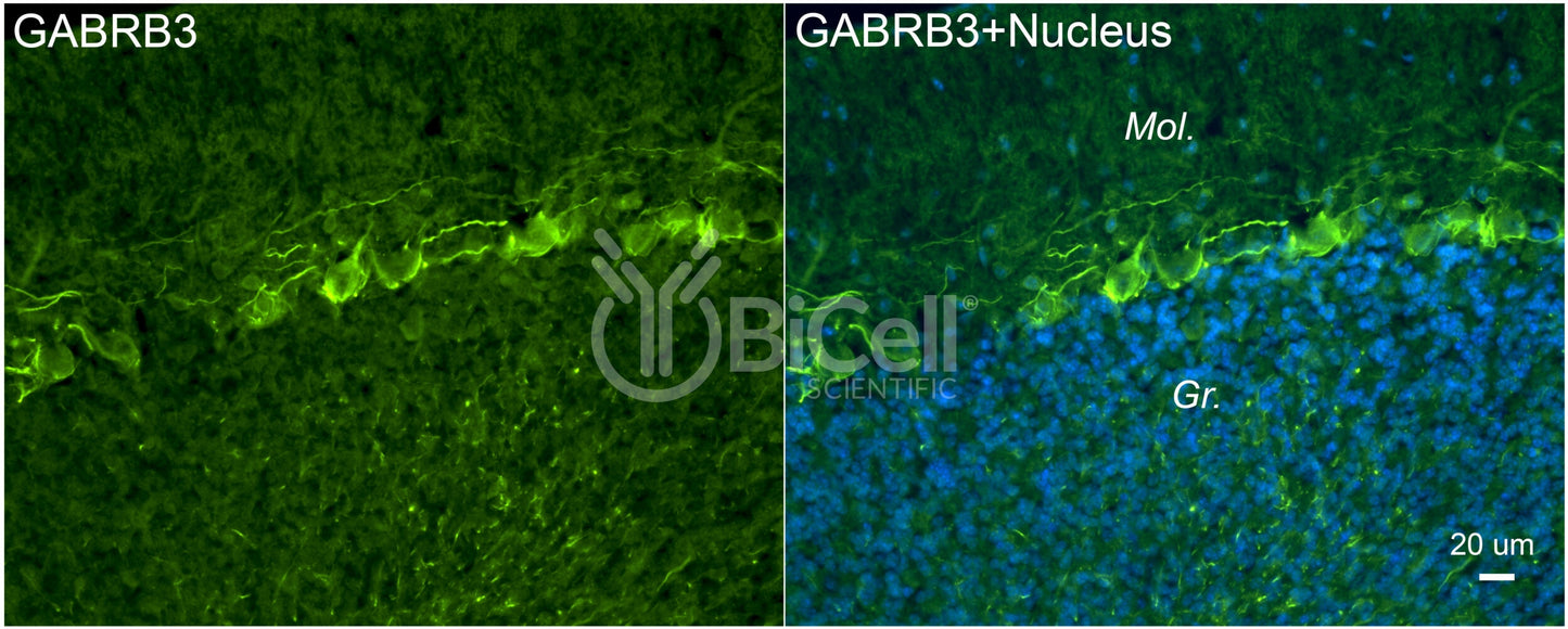 GABRB3 Antibody