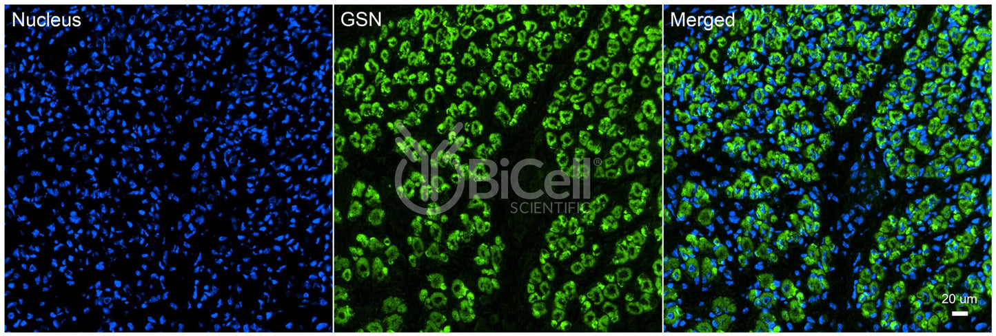 Gelsolin (GSN) Antibody - Western Blot Validated