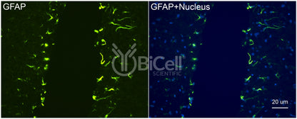GFAP Antibody - Western Blot Validated