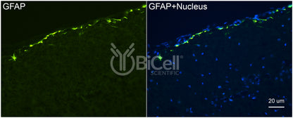 GFAP Antibody - Western Blot Validated