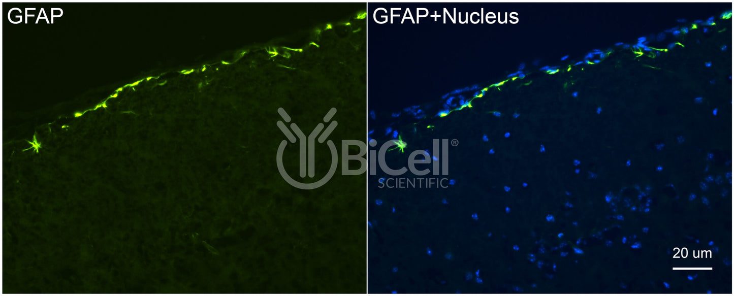 GFAP Antibody