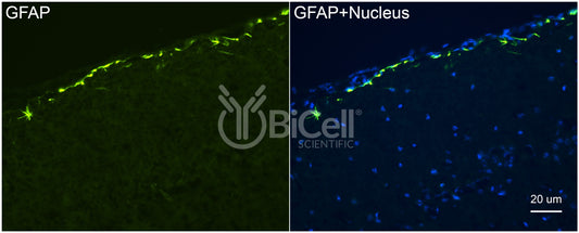 GFAP Antibody