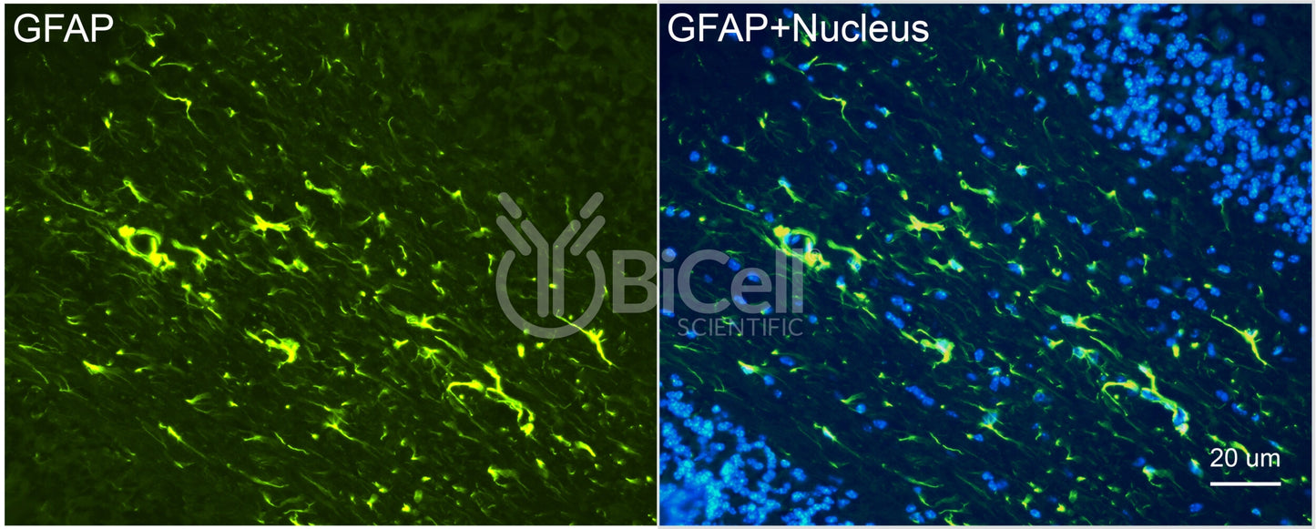 GFAP Antibody - Western Blot Validated