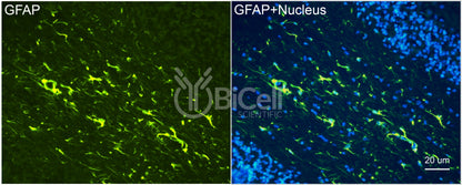 GFAP Antibody - Western Blot Validated