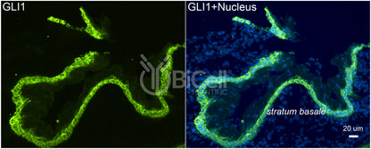 GLI1 Antibody - Western Blot Validated