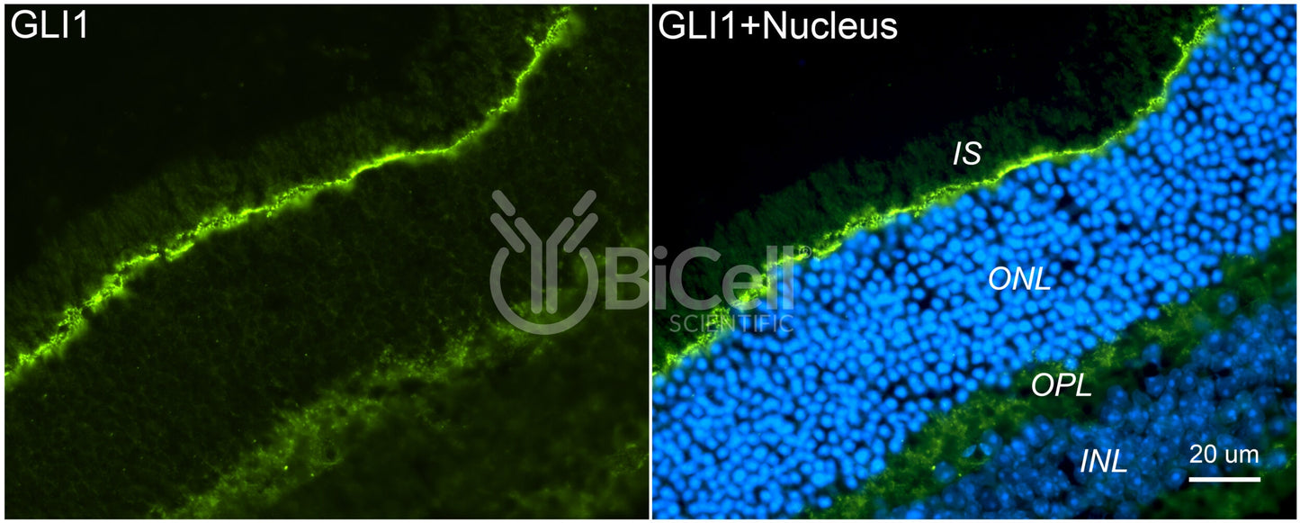 GLI1 Antibody - Western Blot Validated