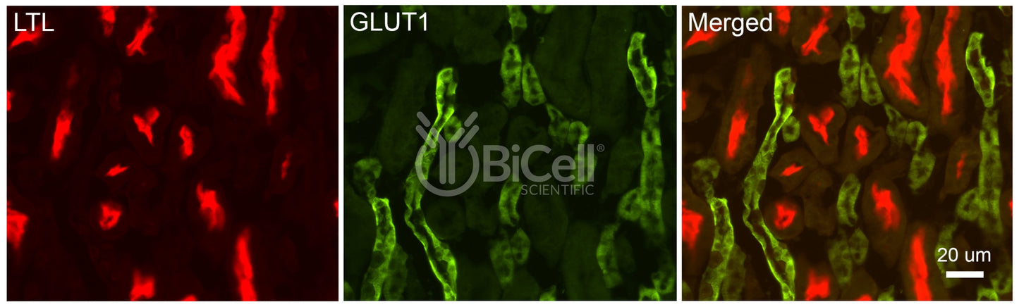 GLUT1 (SLC2A1) Antibody