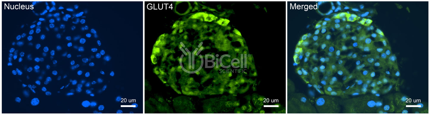 GLUT4 (SLC2A4) Antibody