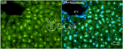 GR (NR3C1) Antibody