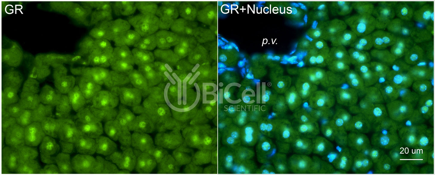 GR (NR3C1) Antibody - FFPE Validated