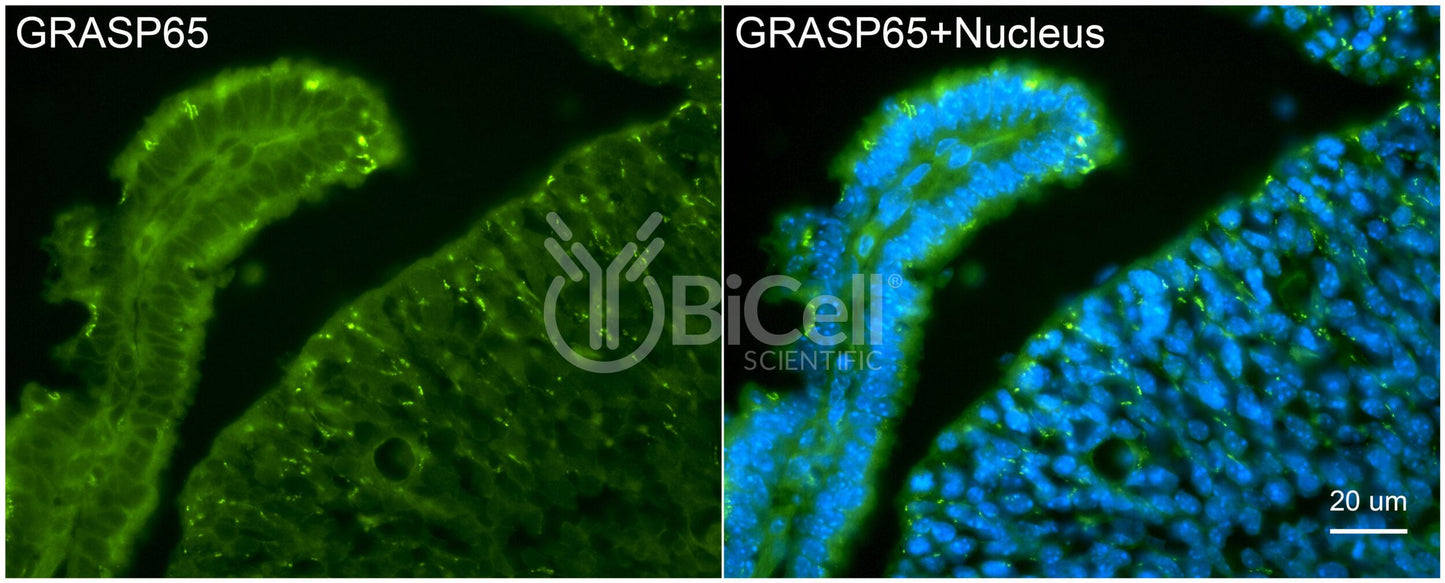 GRASP65 (GORASP1) Antibody - FFPE Validated