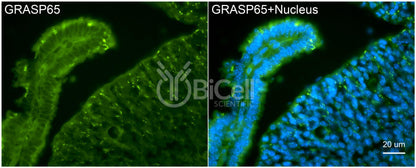 GRASP65 (GORASP1) Antibody - FFPE Validated